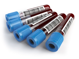 Blood analysis using vaporized sample