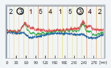 Fig. 2  Typical NIRS Waveforms Blood Flow Fluctuations in Broca's Area (representative channel 11). 