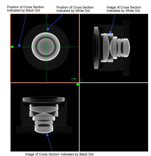 MPT Image (Multiplanar Reconstruction)