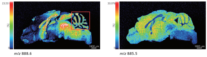 Measurement Results for Whole Brain Sections in Negative Mode